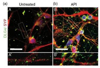 Tim je pronašao apigenin tretirane neuroni (desno) razvijena jače sinapse od netretiranih neurona (lijevo). Zasluge za sliku: Rehen et al.